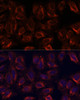 Cell Biology Antibodies 3 Anti-SCGB3A2 Antibody CAB13137