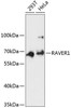 Cell Biology Antibodies 3 Anti-RAVER1 Antibody CAB13138