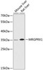 Immunology Antibodies 1 Anti-MRGPRX1 Antibody CAB13142