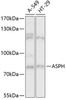 Cell Biology Antibodies 3 Anti-ASPH Antibody CAB13153