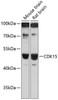 Cell Biology Antibodies 3 Anti-CDK15 Antibody CAB13163