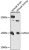 Epigenetics and Nuclear Signaling Antibodies 1 Anti-LSM3 Antibody CAB13189
