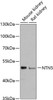 Neuroscience Anti-NTN5 Antibody CAB13200