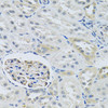 Signal Transduction Antibodies 1 Anti-SLC29A1 Antibody CAB13204