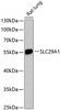 Signal Transduction Antibodies 1 Anti-SLC29A1 Antibody CAB13205