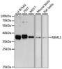 Developmental Biology Anti-RBM11 Antibody CAB13216