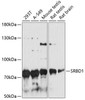 Cell Biology Antibodies 3 Anti-SRBD1 Antibody CAB13223