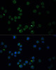 Neuroscience Anti-CHAT Antibody CAB13244
