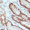 Cell Biology Antibodies 3 Anti-CXCL12 Antibody CAB1325
