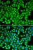 Developmental Biology Anti-KAT5 Antibody CAB13259