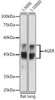 Western blot analysis of extracts of Rat lung, using AGER antibody at 1:5000/1:10000 dilution.
Secondary antibody: HRP Goat Anti-Rabbit IgG (H+L) at 1:10000 dilution.
Lysates/proteins: 25ug per lane.
Blocking buffer: 3% nonfat dry milk in TBST.
Detection: ECL Basic Kit (RM00020).
Exposure time: 1s.