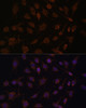 Metabolism Antibodies 1 Anti-ACAT1 Antibody CAB13273