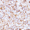 Metabolism Antibodies 1 Anti-ACAT1 Antibody CAB13273