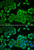 Cell Biology Antibodies 3 Anti-ALDH3A1 Antibody CAB13275