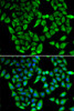 Cell Biology Antibodies 3 Anti-ASIP Antibody CAB13280