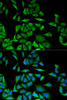Signal Transduction Antibodies 1 Anti-DBI Antibody CAB13293