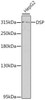 Cell Biology Antibodies 3 Anti-DSP Antibody CAB13299