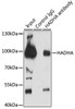 Metabolism Antibodies 1 Anti-HADHA Antibody CAB13310