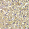 Cell Biology Antibodies 3 Anti-MYBPC2 Antibody CAB13331