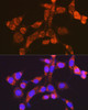 Cell Biology Antibodies 3 Anti-NDUFV1 Antibody CAB13333