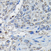 Cell Biology Antibodies 3 Anti-RANGAP1 Antibody CAB13347