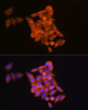 Epigenetics and Nuclear Signaling Antibodies 1 Anti-RRM1 Antibody CAB13348