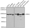 Epigenetics and Nuclear Signaling Antibodies 1 Anti-RRM1 Antibody CAB13348