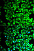 Metabolism Antibodies 1 Anti-TBXAS1 Antibody CAB13362