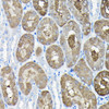 Cell Biology Antibodies 3 Anti-TCP1 Antibody CAB13364