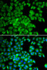 Cell Biology Antibodies 3 Anti-TCP1 Antibody CAB13364