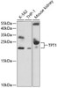 Cell Biology Antibodies 3 Anti-TPT1 Antibody CAB13367
