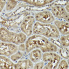 Autophagy Antibodies Anti-VCP Antibody CAB13368