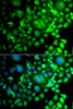 Cell Biology Antibodies 3 Anti-SNX3 Antibody CAB13380