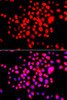 Cell Biology Antibodies 3 Anti-STK19 Antibody CAB13383