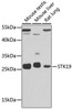 Cell Biology Antibodies 3 Anti-STK19 Antibody CAB13383