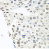 Cell Biology Antibodies 3 Anti-TARDBP Antibody CAB13405