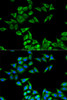 Cell Biology Antibodies 4 Anti-CHMP2B Antibody CAB13410