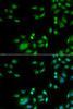 Cell Biology Antibodies 4 Anti-INTS10 Antibody CAB13419