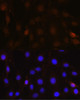 Autophagy Antibodies Anti-NRBF2 Antibody CAB13422
