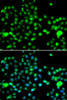 Metabolism Antibodies 1 Anti-IP6K2 Antibody CAB13427