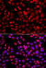 Cell Biology Antibodies 4 Anti-MTUS1 Antibody CAB13437