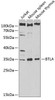 Immunology Antibodies 1 Anti-BTLA Antibody CAB13449