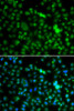 Cell Biology Antibodies 4 Anti-NSUN6 Antibody CAB13454