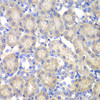 Cell Biology Antibodies 4 Anti-ACY1 Antibody CAB13458