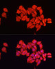 Cell Biology Antibodies 4 Anti-ALDH2 Antibody CAB13463