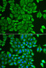 Cell Biology Antibodies 4 Anti-APEH Antibody CAB13467