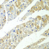 Metabolism Antibodies 1 Anti-SERPINH1 Antibody CAB13474