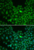 Cell Death Antibodies 1 Anti-CLU Antibody CAB13479