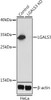 KO Validated Antibodies 1 Anti-LGALS3 Antibody CAB13506KO Validated