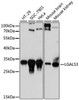 KO Validated Antibodies 1 Anti-LGALS3 Antibody CAB13506KO Validated